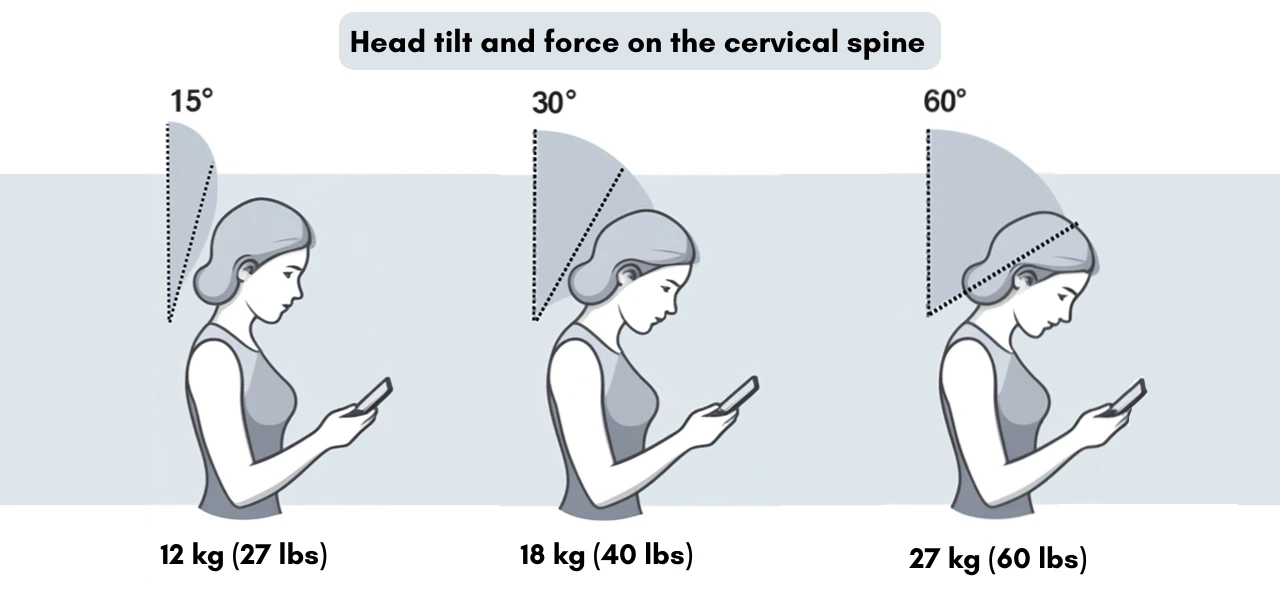 Head tilt and force on the cervical spine.